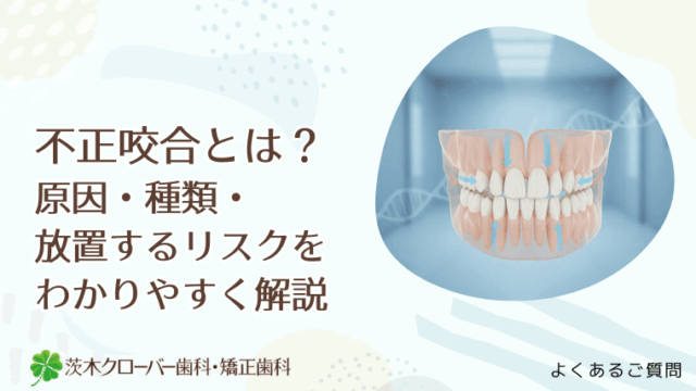 不正咬合とは？原因・種類・放置するリスクまで歯科医視点でわかりやすく解説