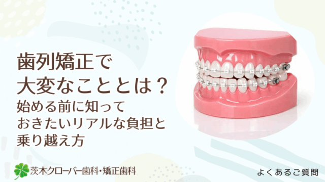 歯列矯正で大変なこととは？始める前に知っておきたいリアルな負担と乗り越え方