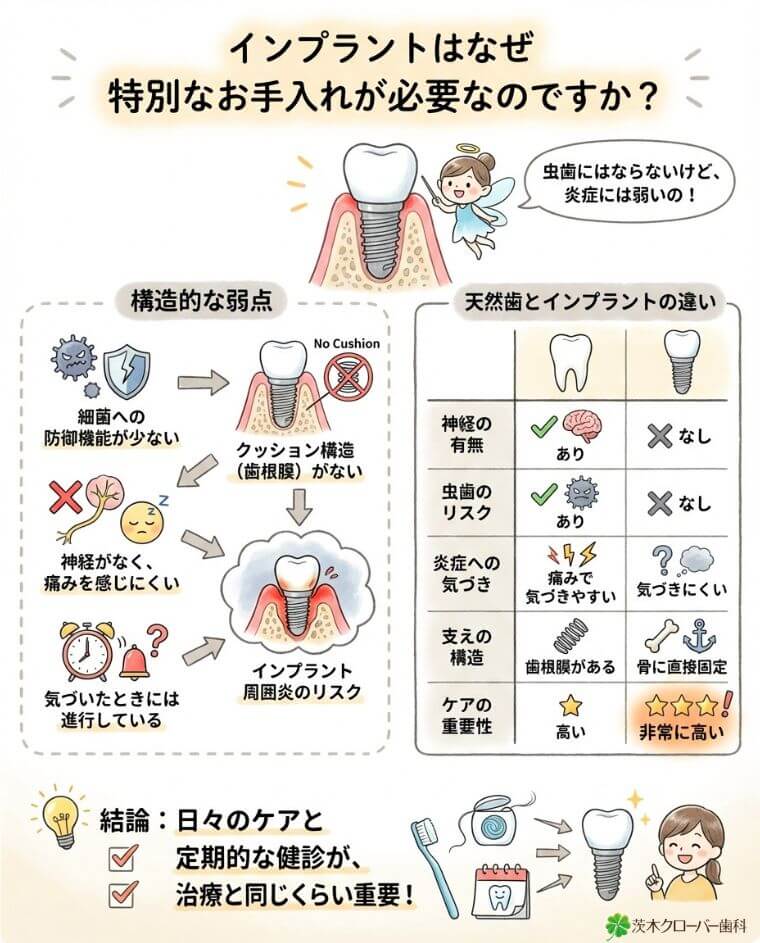 インプラントはなぜ特別なお手入れが必要なのですか？