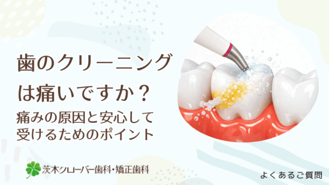 歯のクリーニングは痛いですか？痛みの原因と安心して受けるためのポイント