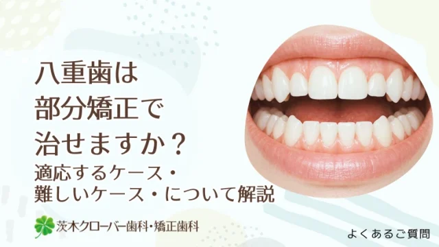 八重歯は部分矯正で治せますか？適応するケース・難しいケース・について解説