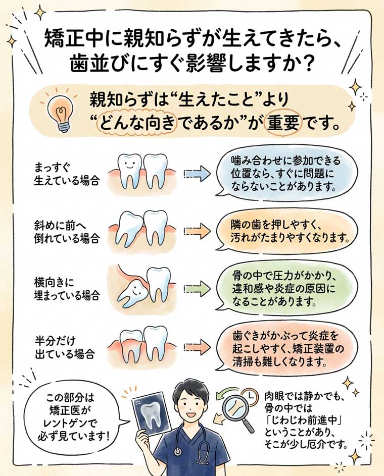矯正中に親知らずが生えてきたら、歯並びにすぐ影響しますか？の図解