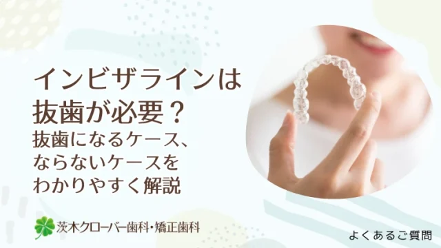 インビザラインは抜歯が必要？抜歯になるケース、ならないケースをわかりやすく解説