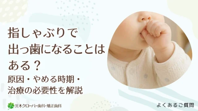 指しゃぶりで出っ歯になることはある？原因・やめる時期・治療の必要性を解説