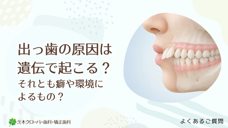 出っ歯の原因は遺伝で起こる？それとも癖や環境によるもの？