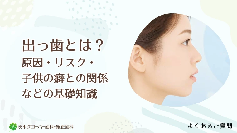 出っ歯とは？原因・リスク・子供の癖との関係までわかる基礎知識