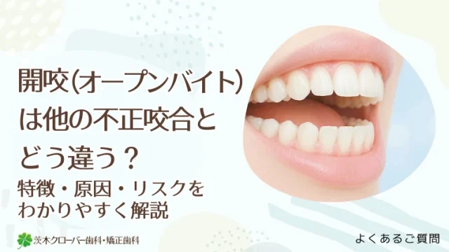 開咬（オープンバイト）は他の不正咬合とどう違う？特徴・原因・リスクをわかりやすく解説