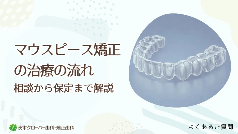 マウスピース矯正の治療の流れ｜相談から保定まで解説