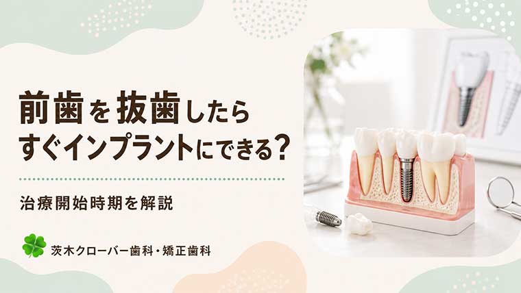 前歯を抜歯したらすぐインプラントにできる？治療開始時期を解説