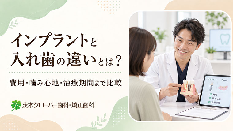 インプラントと入れ歯の違いとは？費用・噛み心地・治療期間まで比較