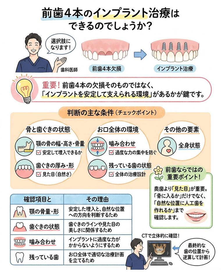 前歯4本のインプラント治療はできるのでしょうか？の図解