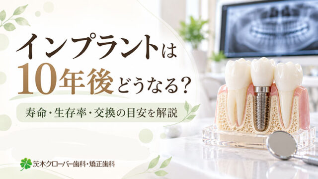インプラントは10年後どうなる？寿命・生存率・交換の目安を解説