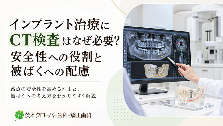 インプラント治療にCT検査はなぜ必要？安全性を高める事前診断の重要性