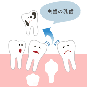 永久歯が正常な位置に生えない