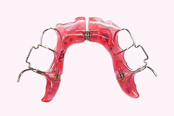 プレート（床矯正）