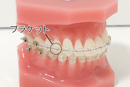 ホワイトブラケット